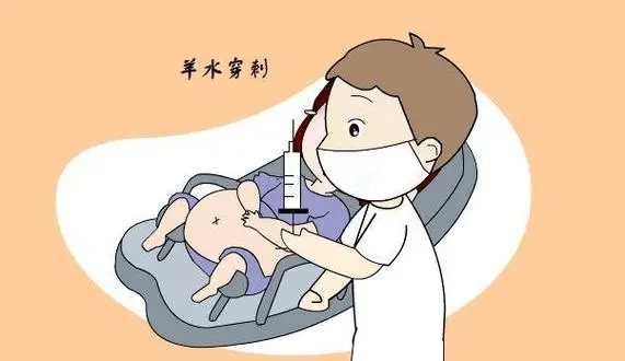 泰国穿刺 泰国试管还要羊水穿刺